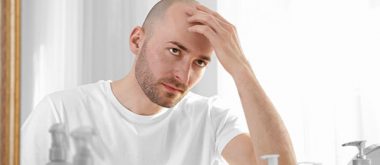 can testosterone related baldness cause prostate cancer 2
