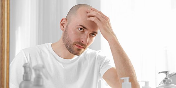 can testosterone related baldness cause prostate cancer 2