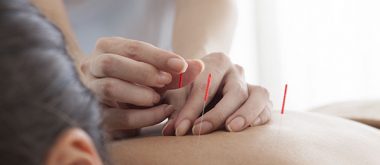 acupuncture for hot flashes