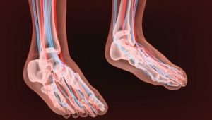 Hormonal Imbalances, a Cause of Peripheral Neuropathy 1