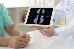 Menopause Status a Better Indicator for Mammograms Than Age 1