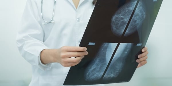 MRIs Better Than Mammograms for Dense Breast Tissue? 1