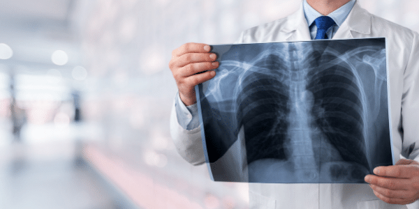Why We Become More Susceptible to Pneumonia as We Age 1