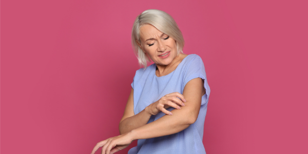 Menopausal Eczema: Everything You Need to Know