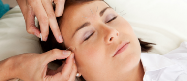 Relieving Menopausal Migraine With Acupuncture