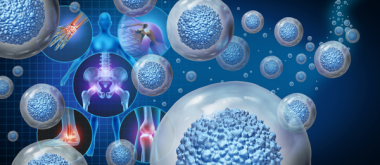 Stem Cell Therapy for Repairing Joint Damage