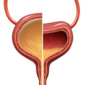 Overactive Bladder and Menopause: Understanding the Connection 1