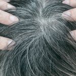 Can Gray Hair be Reversed?