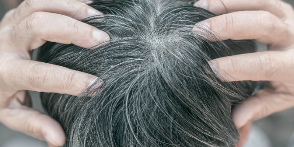 Can Gray Hair be Reversed?