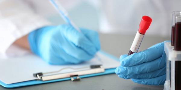 Blood Test Promises Early Detection of Dementia