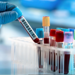 The Common Blood Test that Predicts How Quickly Alzheimer's Will Develop