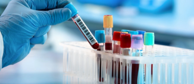 The Common Blood Test that Predicts How Quickly Alzheimer's Will Develop