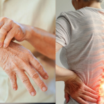 Two Key Genes Identified that Link Rheumatoid Arthritis and Osteoporosis 1