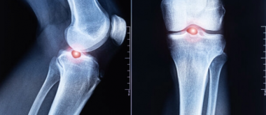 Scientists May Have Found a Way to Strengthen Bones for Life