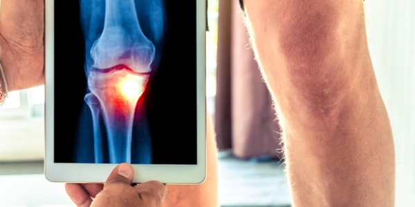 Simple Therapies are Often More Effective than Medication in Relieving Knee osteoarthritis.