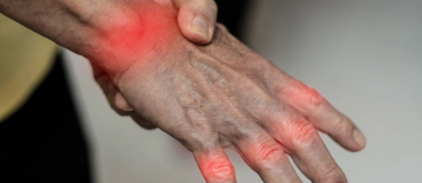 A Traditional Brazilian Plant Shows Unexpected Effectiveness Against Arthritis