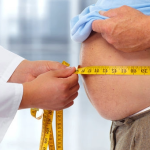 Blood Tests Show that Obesity Rapidly Accelerates the Progression of Alzheimer's Disease 2