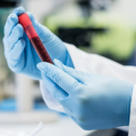 A Simple Blood Test Can Predict Alzheimer's Years Before Memory Loss 2