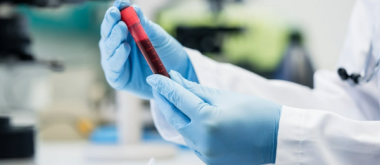 A Simple Blood Test Can Predict Alzheimer's Years Before Memory Loss 2