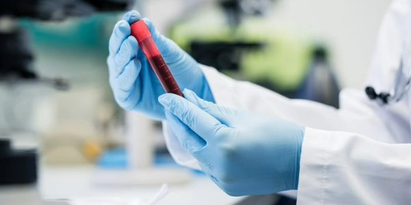 A Simple Blood Test Can Predict Alzheimer's Years Before Memory Loss 2