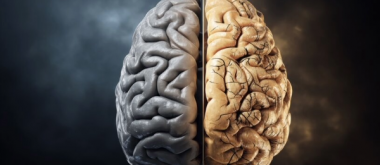 Menopause is Associated With the Loss of Gray Matter in Important regions of the Brain 1