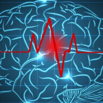 A Stroke Triggers a Hidden Change in the Brain that Resembles Rejuvenation