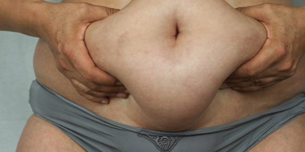 A New Way to Stop Dangerous Belly Fat as You Age 1