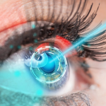 New Heat Treatment could slow the progression of dry age-related macular degeneration and protect against vision loss