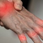 Air Pollution May Worsen Rheumatoid Arthritis 1