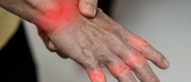 Air Pollution May Worsen Rheumatoid Arthritis 1