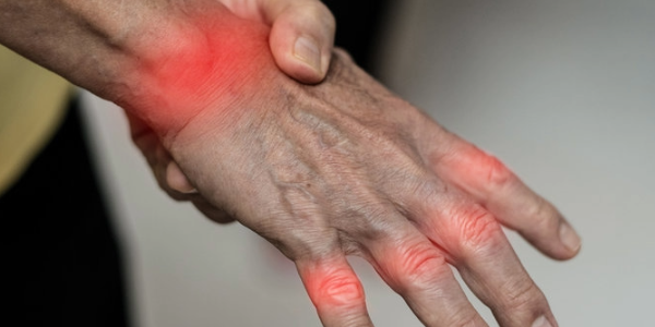 Air Pollution May Worsen Rheumatoid Arthritis 1