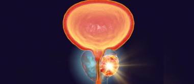 New Findings on Prostate Cancer: From Treatment Resistance to Diet